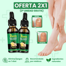 Pies de Oro - Tratamiento Anti Hongos 100% Natural