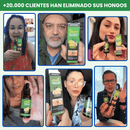 Pies de Oro - Tratamiento Anti Hongos 100% Natural